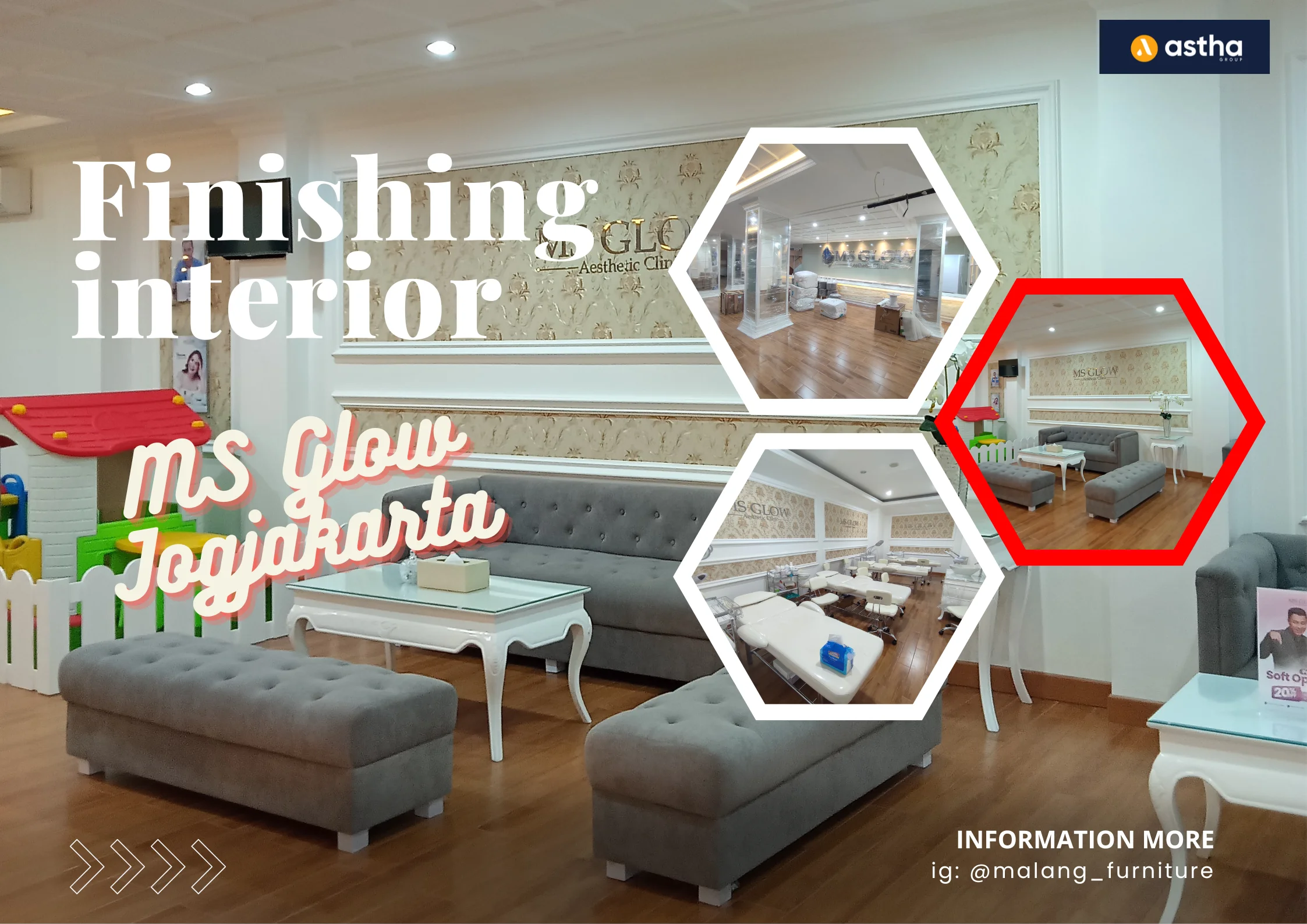 HASIL AKHIR PENGERJAAN INTERIOR MS GLOW JOGJAKARTA